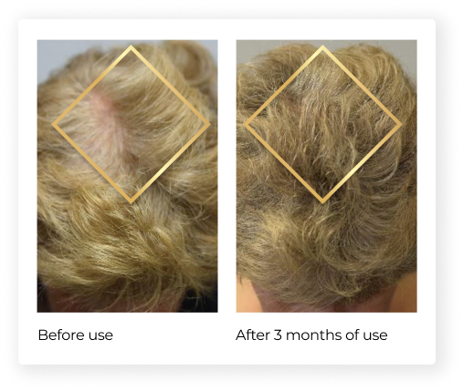 Dr Raj Super Haircare Homeopathy Tablets for Hairloss, Grey hair – Homeomart