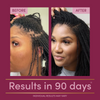Hair Growth