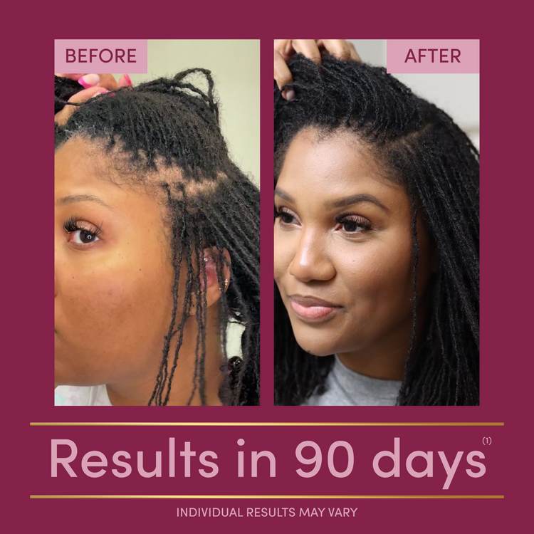 Hair Growth